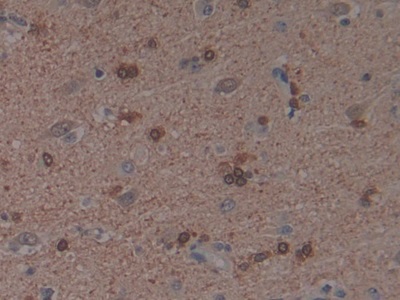 Polyclonal Antibody to p21 Protein Activated Kinase 1 (PAK1)