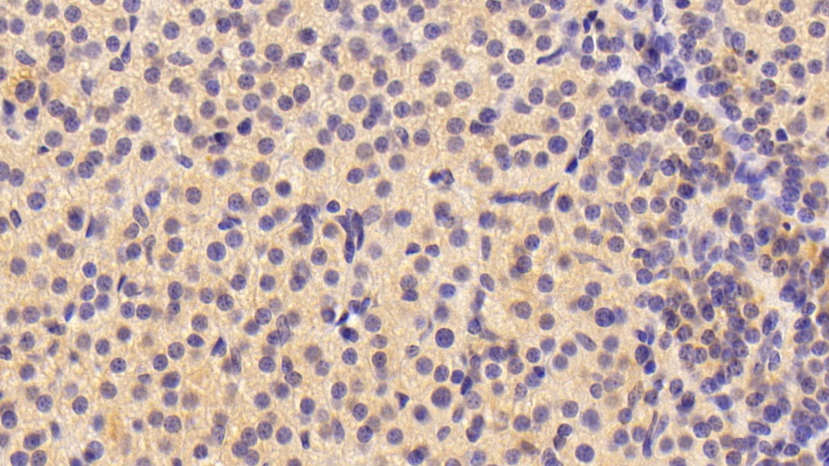 Polyclonal Antibody to Neuritin 1 (NRN1)