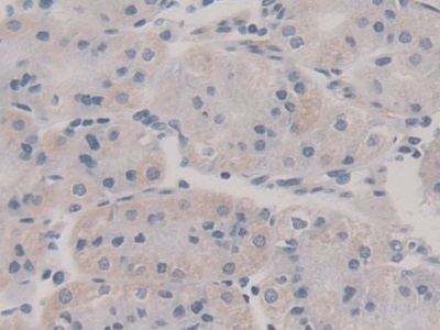 Polyclonal Antibody to Neudesin Neurotrophic Factor (NENF)