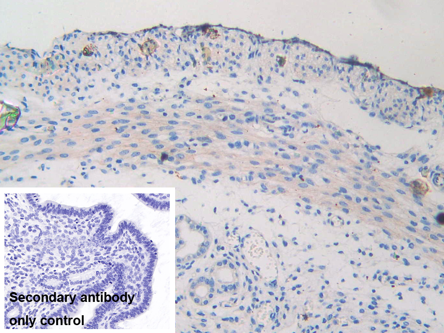 Polyclonal Antibody to Nexilin (NEXN)