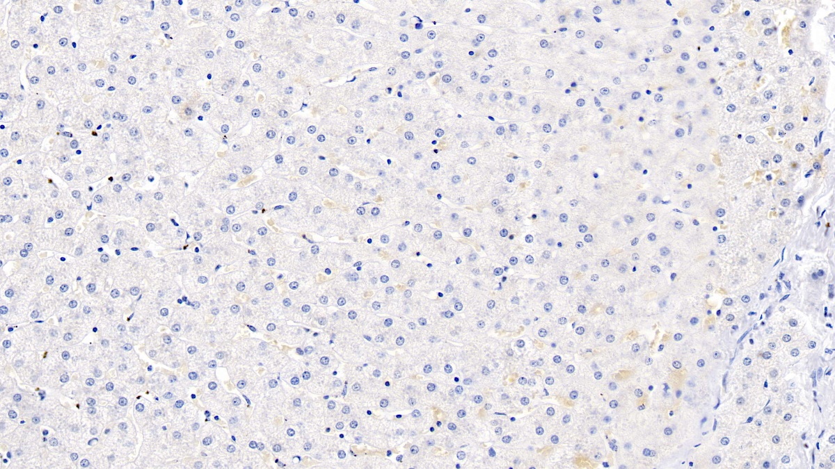 Polyclonal Antibody to Neurogenic Differentiation 6 (NEUROD6)