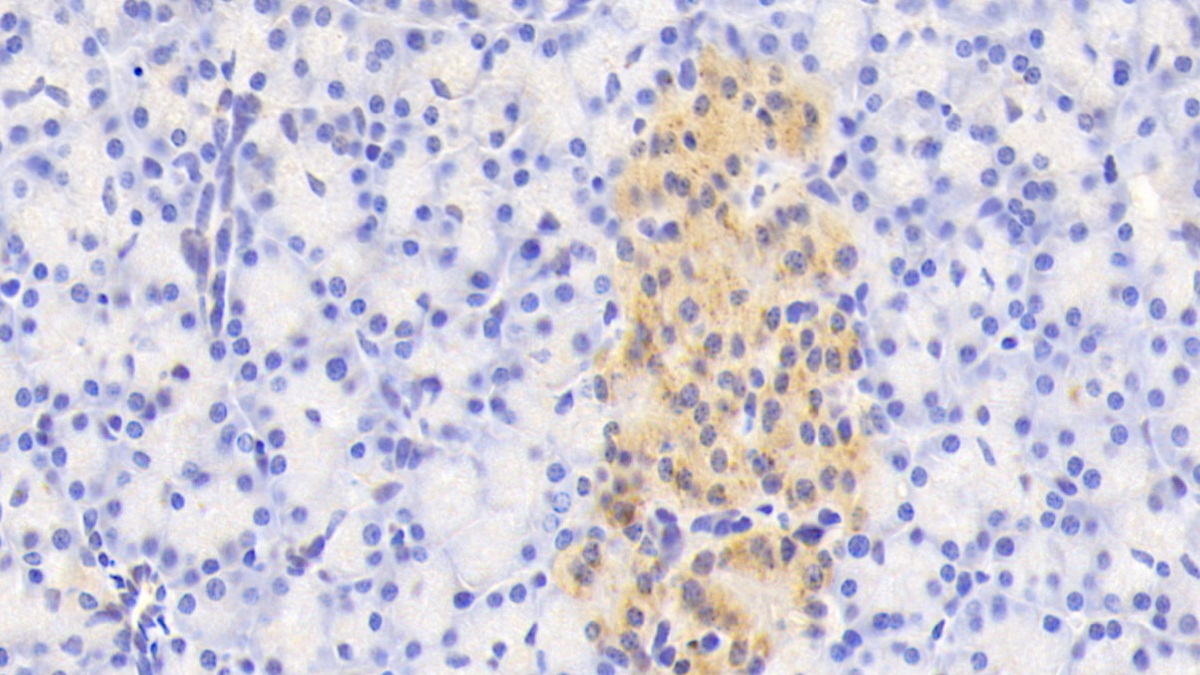 Polyclonal Antibody to N-Acetylgalactosaminidase Alpha (NAGa)