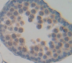 Polyclonal Antibody to N-Acetylgalactosaminidase Alpha (NAGa)