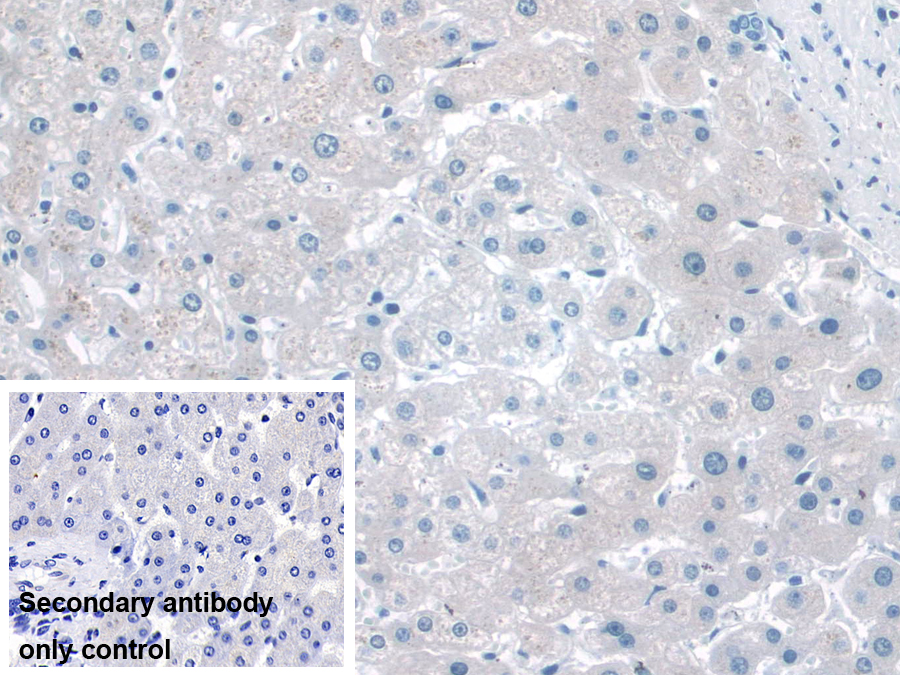 Polyclonal Antibody to NAD Kinase (NADK)