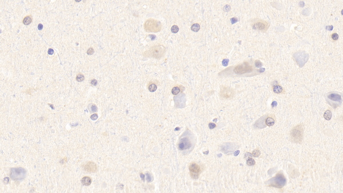 Polyclonal Antibody to Myomesin 2 (MYOM2)