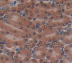 Polyclonal Antibody to Myotrophin (MTPN)