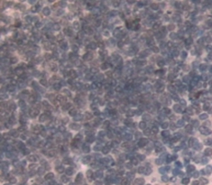 Polyclonal Antibody to N-Methylpurine DNA Glycosylase (MPG)