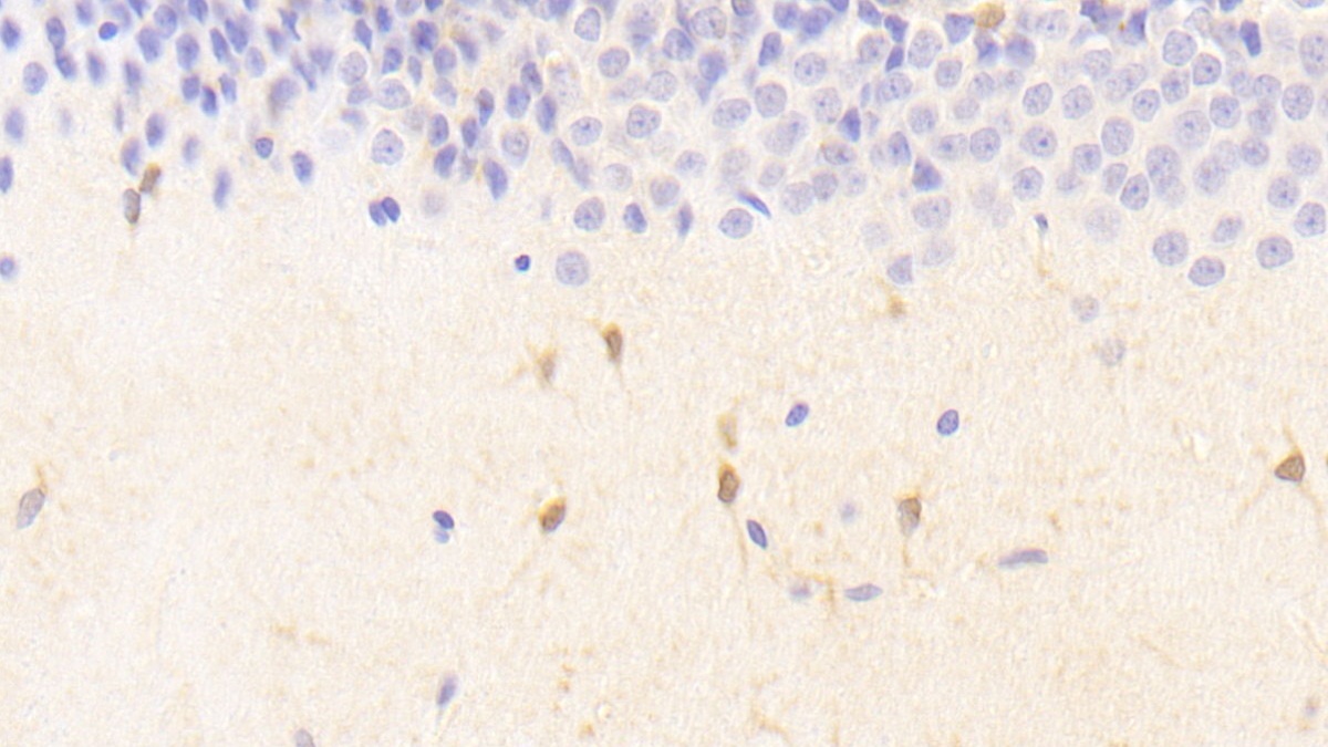 Polyclonal Antibody to N-Methylpurine DNA Glycosylase (MPG)