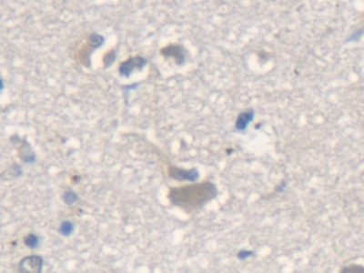 Polyclonal Antibody to Malic Enzyme 2, NADP+ Dependent, Mitochondrial (ME2)