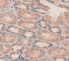 Polyclonal Antibody to Malate Dehydrogenase 1 (MDH1)