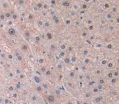 Polyclonal Antibody to MYC Associated Factor X (MAX)