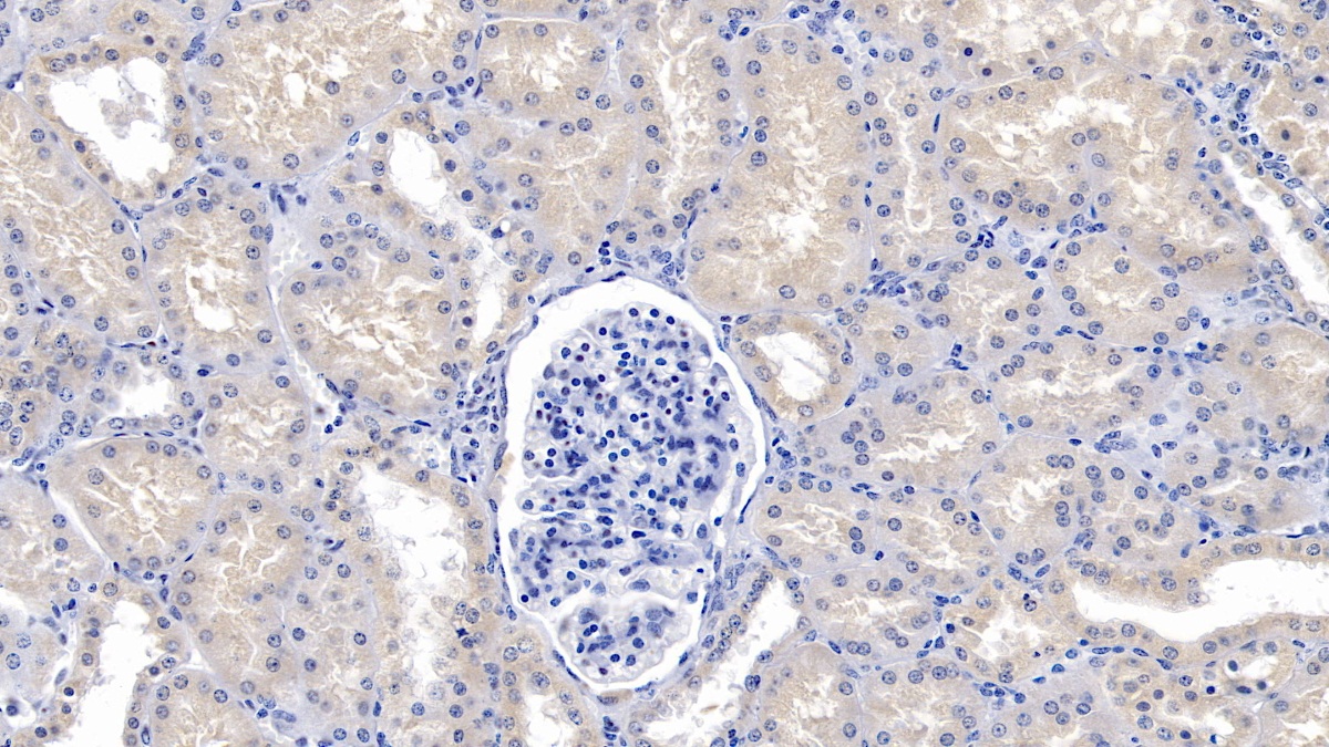 Polyclonal Antibody to Lymphocyte Antigen 96 (LY96)