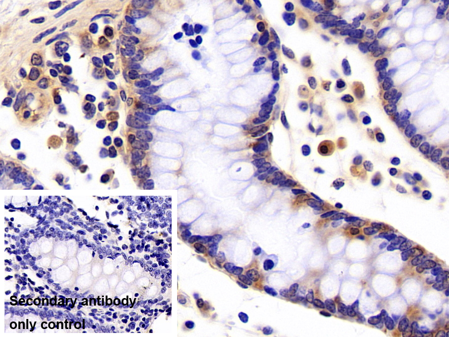 Polyclonal Antibody to Leucine Rich Repeat In FLII Interacting Protein 1 (LRRFIP1)