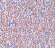 Polyclonal Antibody to Lymphocyte Adaptor Protein (Lnk)