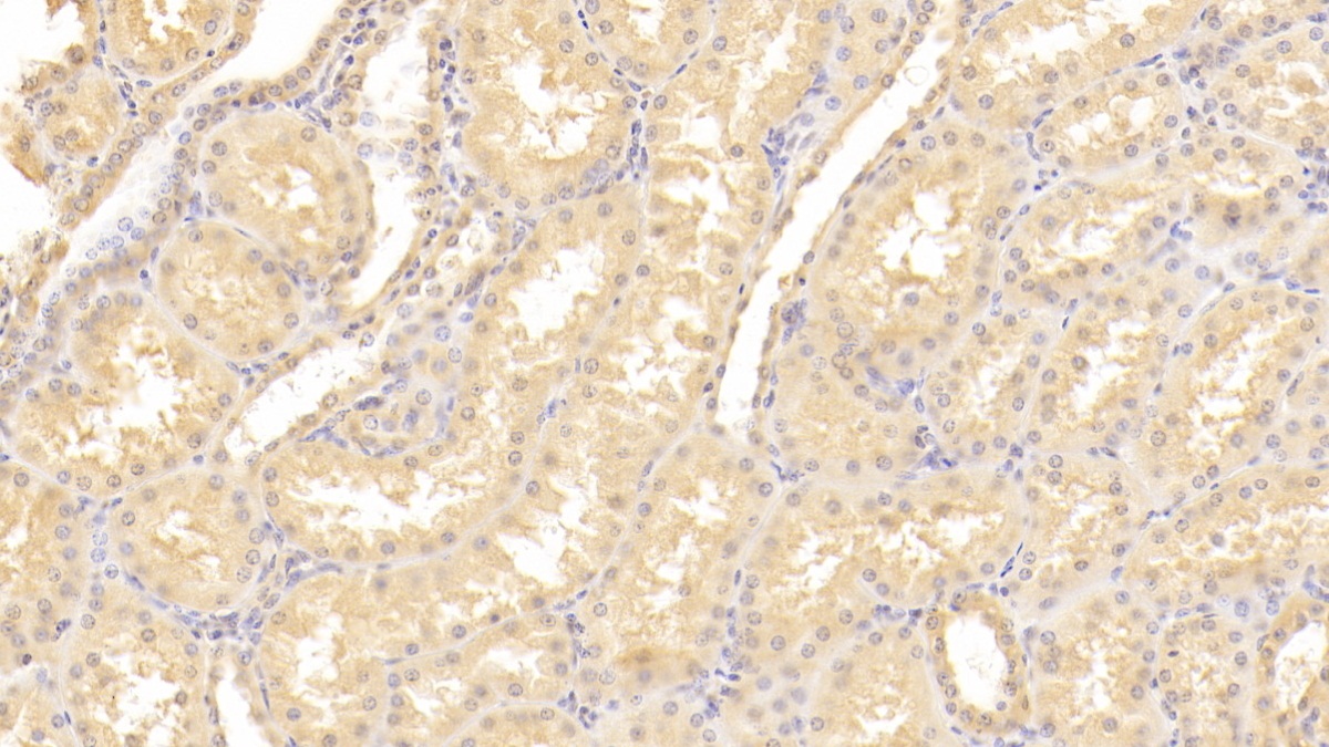 Polyclonal Antibody to Lectin, Mannose Binding 2 (LMAN2)