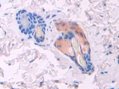 Polyclonal Antibody to Klotho Beta (KLb)