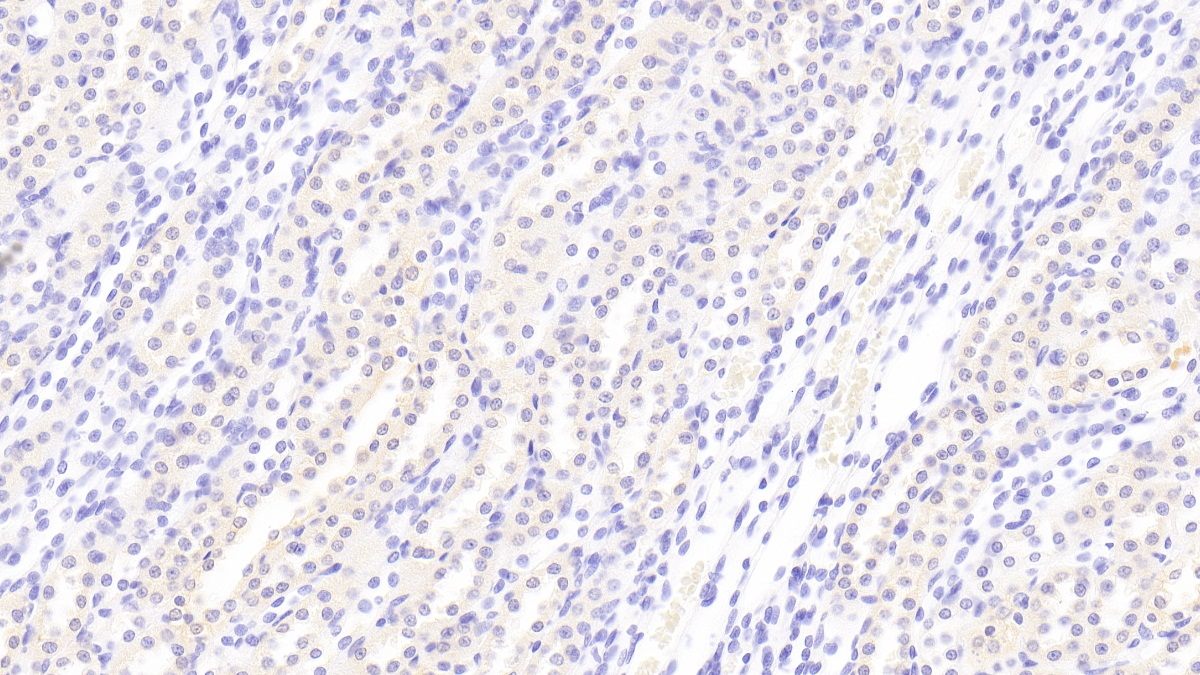 Polyclonal Antibody to Klotho (KL)