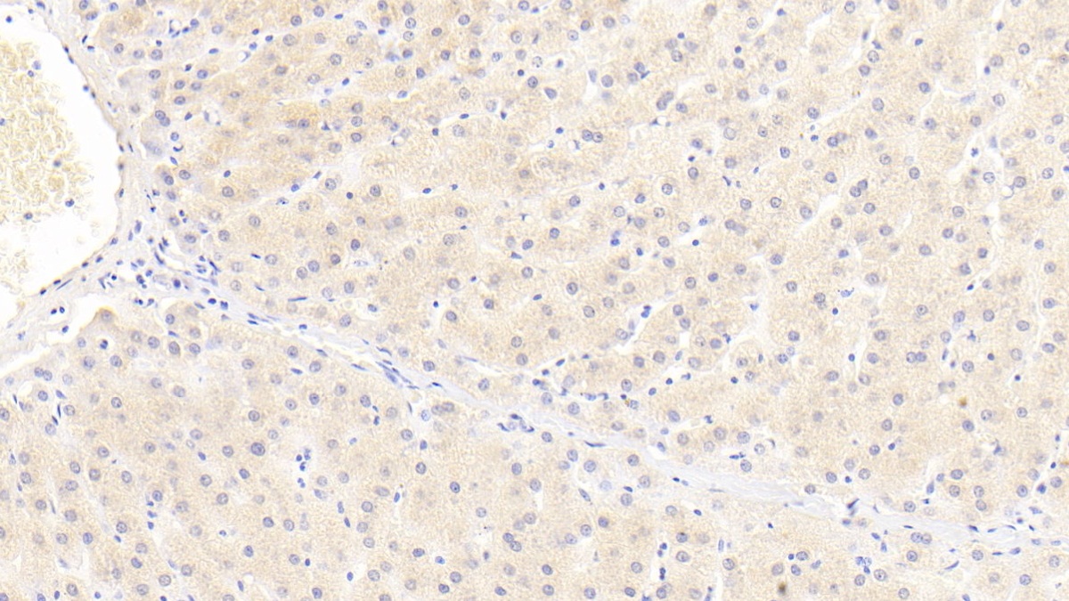 Polyclonal Antibody to Inter Alpha-Globulin Inhibitor H4 (ITIH4)