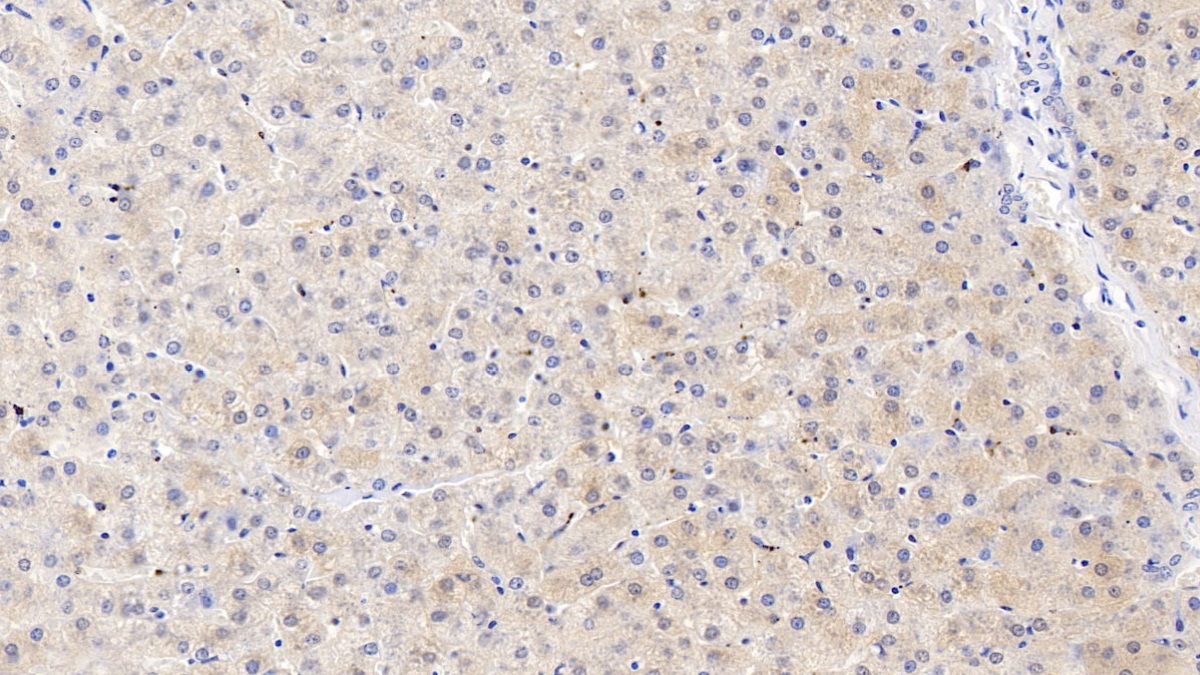 Polyclonal Antibody to Inter Alpha-Globulin Inhibitor H4 (ITIH4)