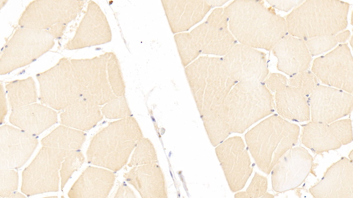 Polyclonal Antibody to Inter Alpha-Globulin Inhibitor H3 (ITIH3)