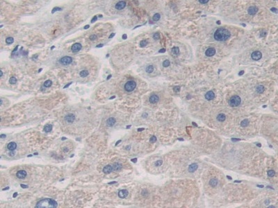 Polyclonal Antibody to Inter Alpha-Globulin Inhibitor H1 (ITIH1)