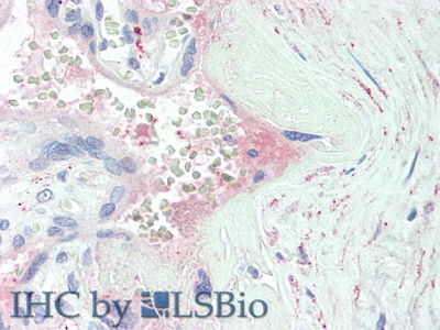 Polyclonal Antibody to Inter Alpha-Globulin Inhibitor H1 (ITIH1)