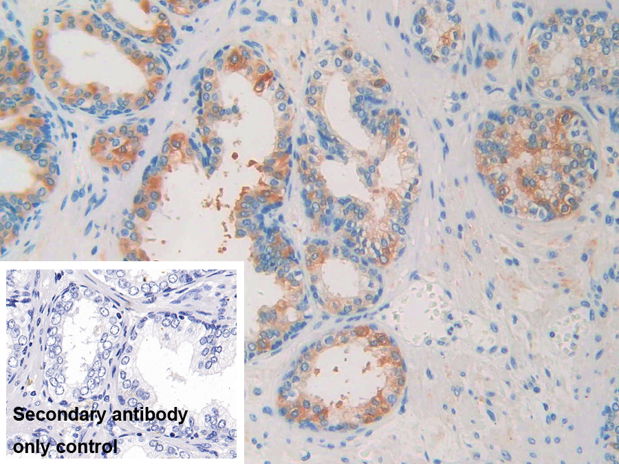 Polyclonal Antibody to Immunoglobulin Superfamily Containing Leucine Rich Repeat Protein (ISLR)