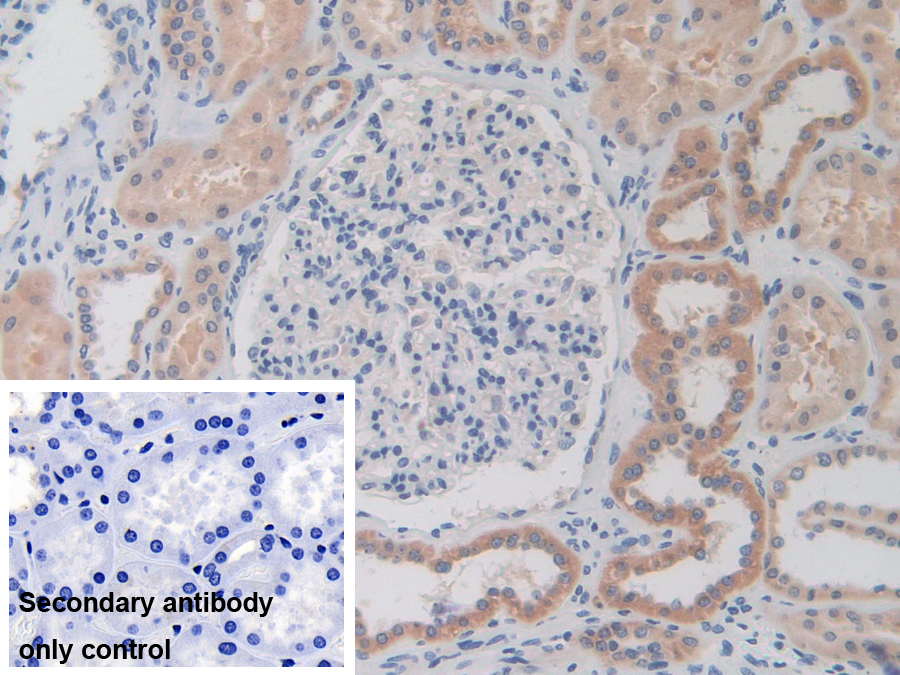 Polyclonal Antibody to Iron Responsive Element Binding Protein 2 (IREB2)