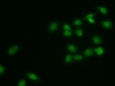 Polyclonal Antibody to Insulin Promoter Factor 1 (IPF)