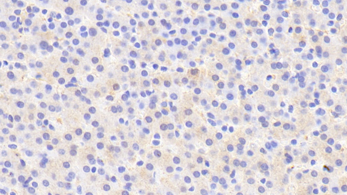 Polyclonal Antibody to Iduronate-2-Sulfatase (IDS)