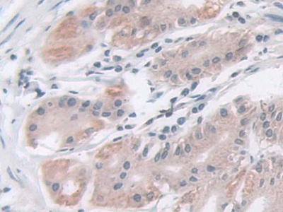 Polyclonal Antibody to Isocitrate Dehydrogenase 2, mitochondrial (IDH2)