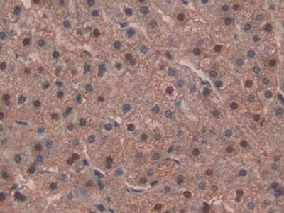 Polyclonal Antibody to Isocitrate Dehydrogenase 1, Soluble (IDH1)