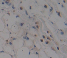 Polyclonal Antibody to Zinc Ribbon Domain Containing Protein 1 (ZNRD1)