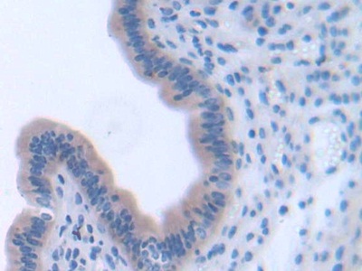 Polyclonal Antibody to Pleckstrin Homology Domain Containing Family A, Member 1 (PLEKHA1)