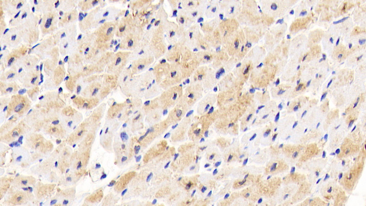 Polyclonal Antibody to Glycerol-3-Phosphate Acyltransferase, Mitochondrial (GPAM)