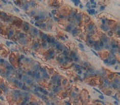 Polyclonal Antibody to Glycoprotein A33 (GPA33)