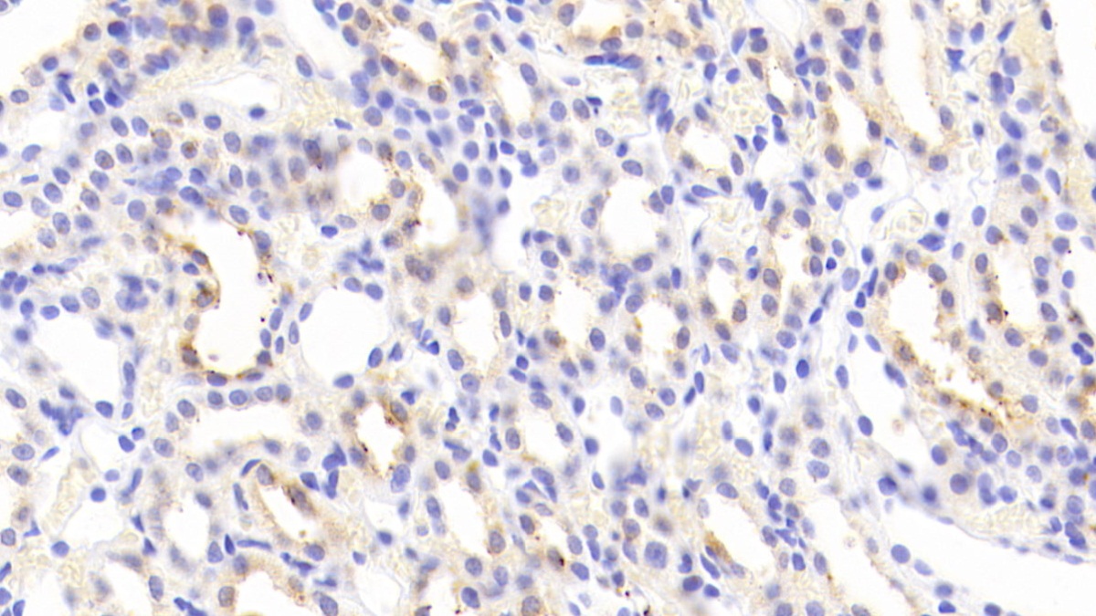 Polyclonal Antibody to Galactose-3-O-Sulfotransferase 1 (GAL3ST1)