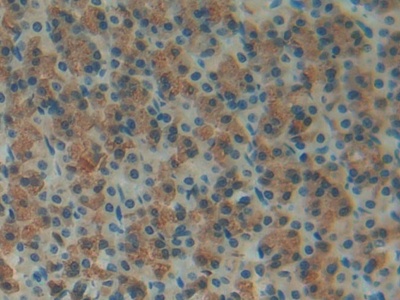 Polyclonal Antibody to FOS Like Antigen 1 (FOSL1)