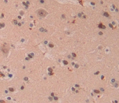 Polyclonal Antibody to Fragile X Mental Retardation 1 (FMR1)