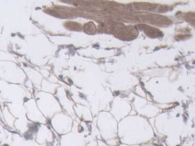 Polyclonal Antibody to Filaggrin (FLG)