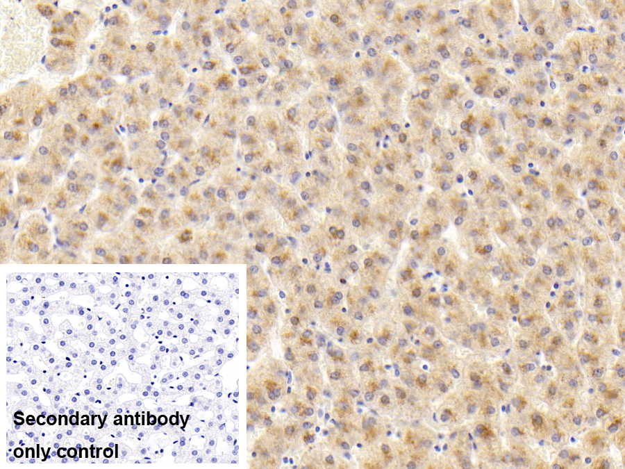 Polyclonal Antibody to Fidgetin (FIGN)