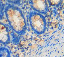 Polyclonal Antibody to Feline Sarcoma Oncogene (FES)