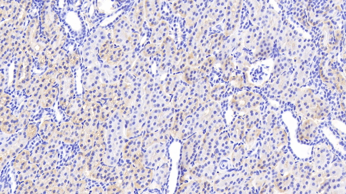 Polyclonal Antibody to Fumarylacetoacetate Hydrolase (FAH)