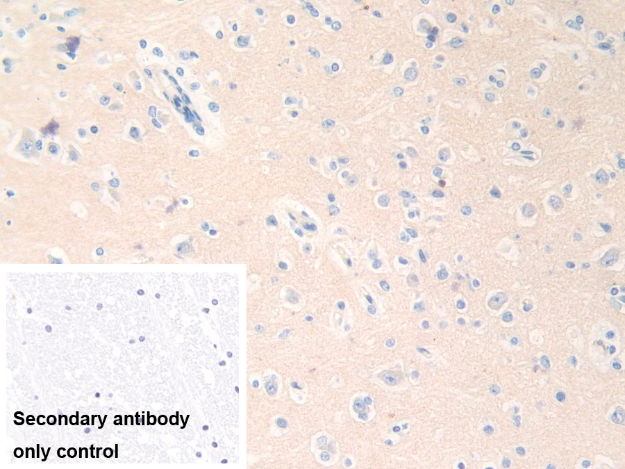 Polyclonal Antibody to Epsin 1 (EPN1)