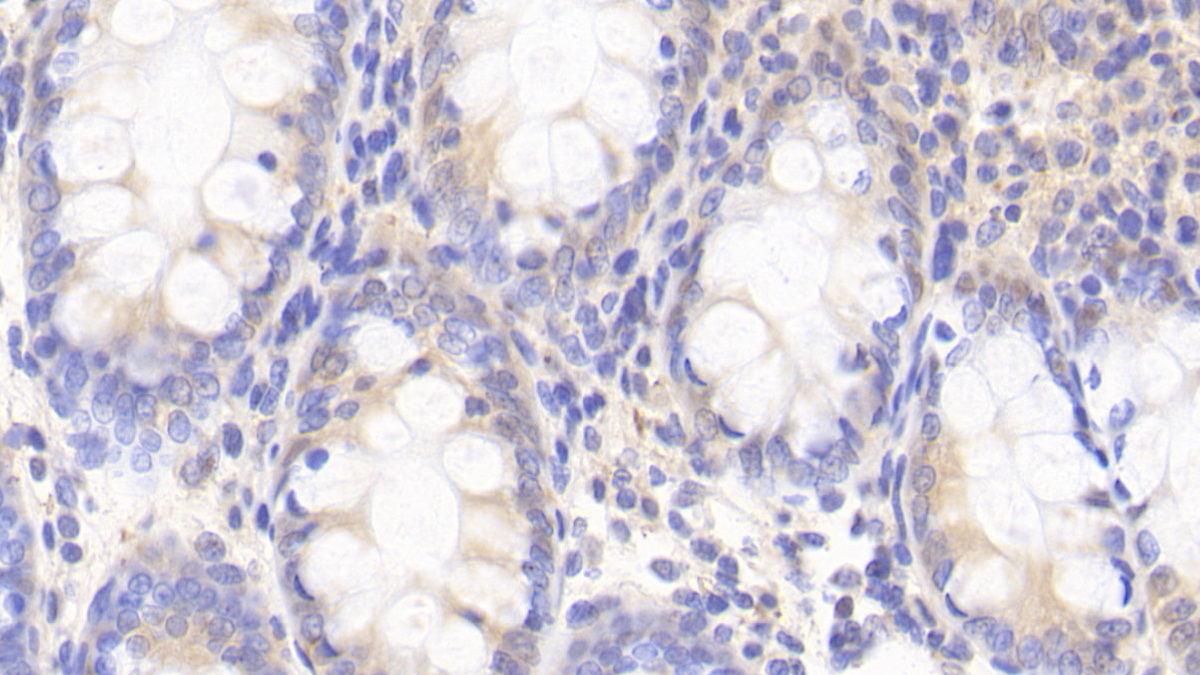 Polyclonal Antibody to Dual Specificity Tyrosine Phosphorylation Regulated Kinase 1A (DYRK1A)