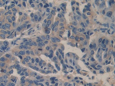 Polyclonal Antibody to Biglycan (BGN)