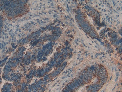 Polyclonal Antibody to Biglycan (BGN)