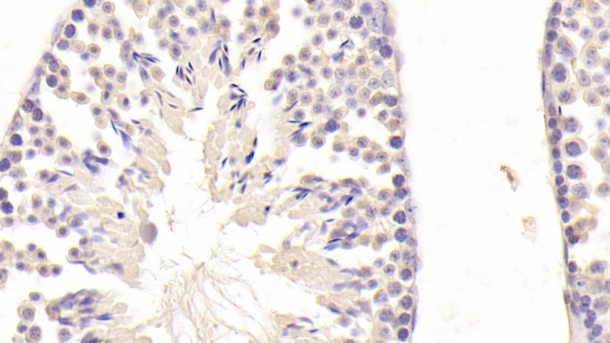 Polyclonal Antibody to Epiphycan (EPYC)