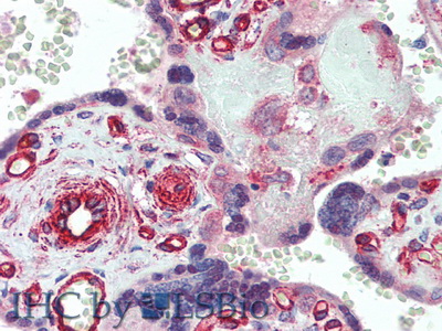 Polyclonal Antibody to Delta Like Protein 4 (dLL4)