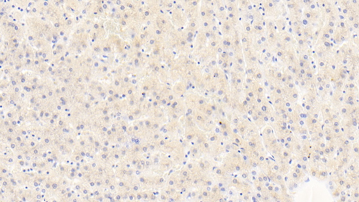 Polyclonal Antibody to Dolichyl Diphosphooligosaccharide Protein Glycosyltransferase (DDOST)